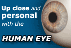 Auge-Krankheit